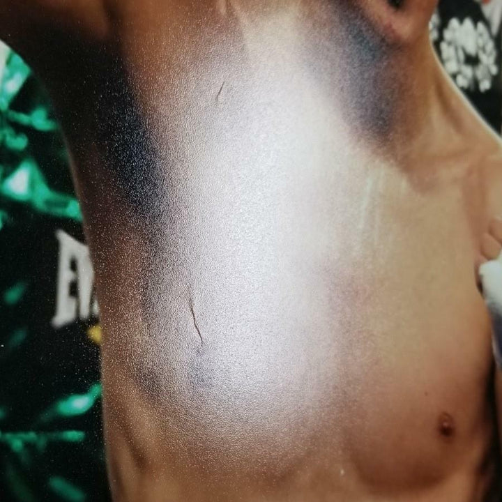 Leo Santa Cruz signed "WBC Champ" 16x20 Photo UFC MMA Autograph ~ BAS COA