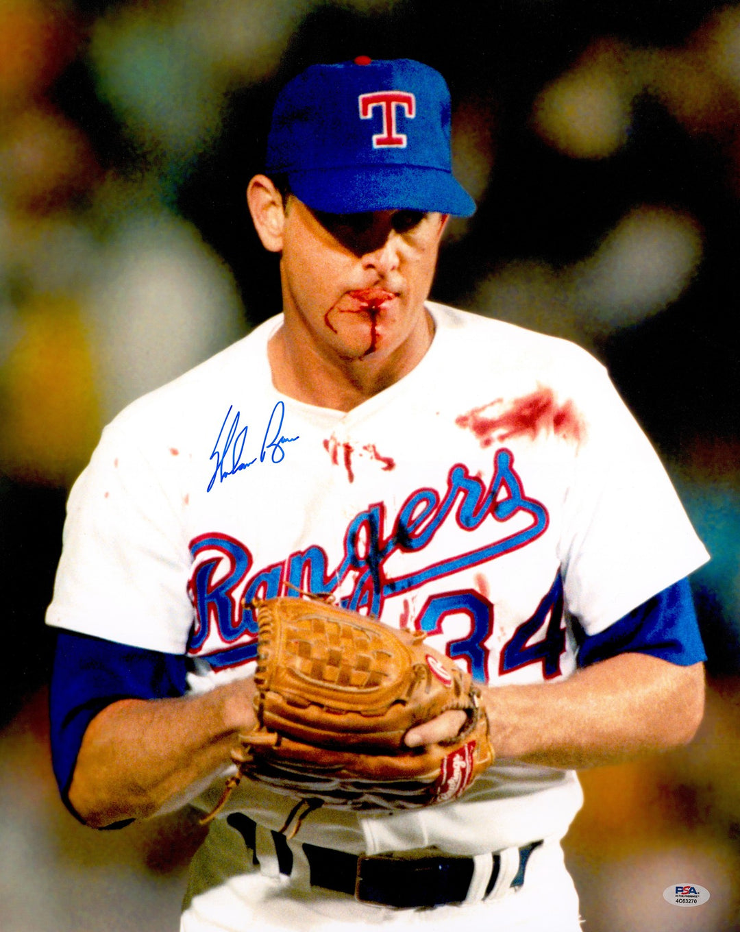 Nolan Ryan Signed Rangers Bloody Lip 16x20 Photo PSA/DNA ITP