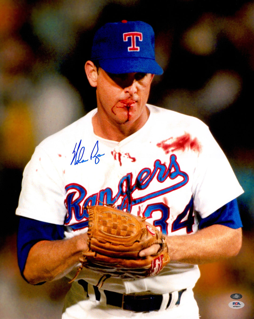Nolan Ryan Signed 16x20 Photo Texas Rangers Bloody Lip PSA/DNA